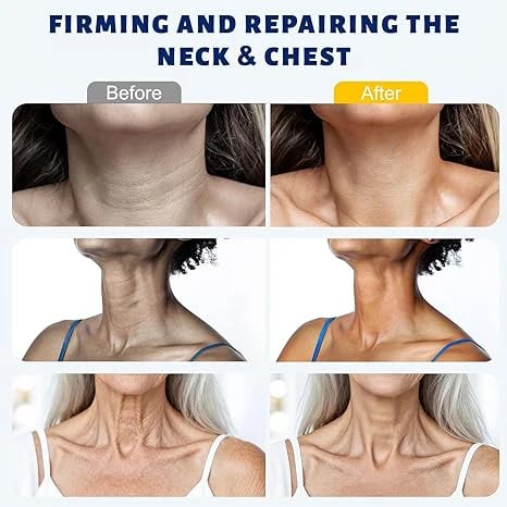 ✨ Roller Massage Cream — 🧴 Infused with Retinol & Hyaluronic Acid | Firms the Neck, Reduces Wrinkles & Double Chin