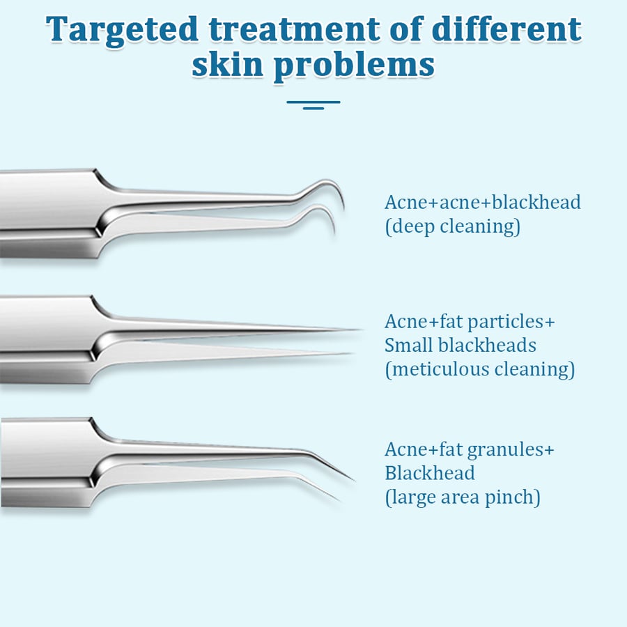 🔥HOT SALE Professional Facial Blackhead Remover Tweezers