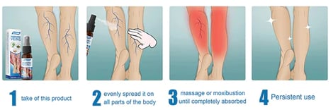Varicose Veins Application