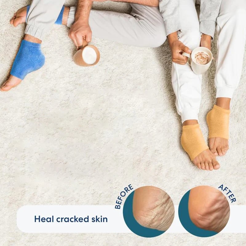 Breathable open toe heel sleeve design